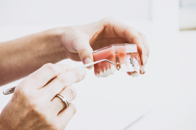 Are Dental Implants for you?